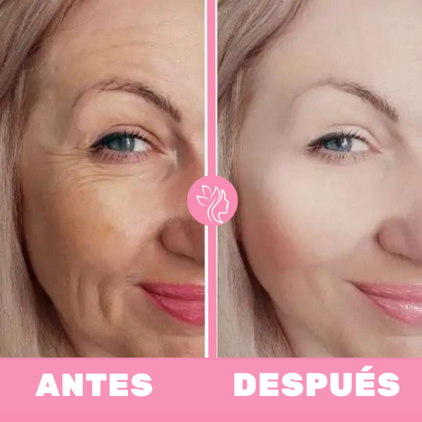 ANTES-_14_